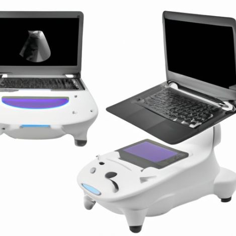 white medical Portable 3D 4D ultrasound scanner laptop ultrasound machine machine with color doppler ultrasound scanner ZHUYUE 2288Z Black and