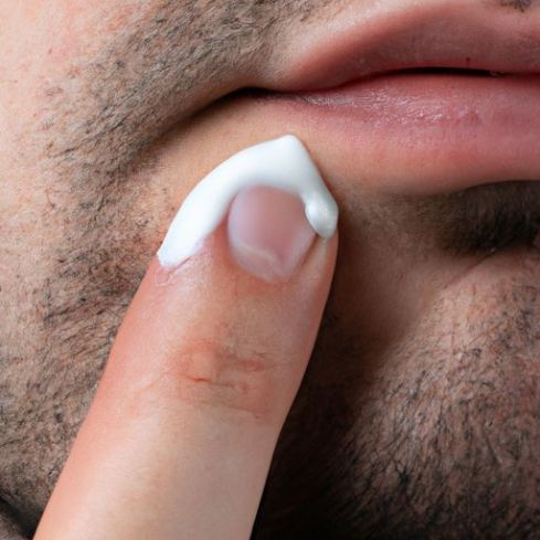 Pimple Cream for Men beauty skin Acne Treatment Men's Skin Care Removal Best